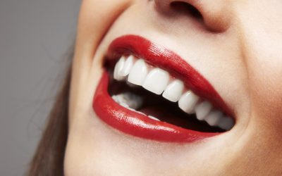 Full Mouth Dental Veneers: What You Need to Know